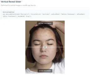 Premium Before After Media Slider (Image & Video)