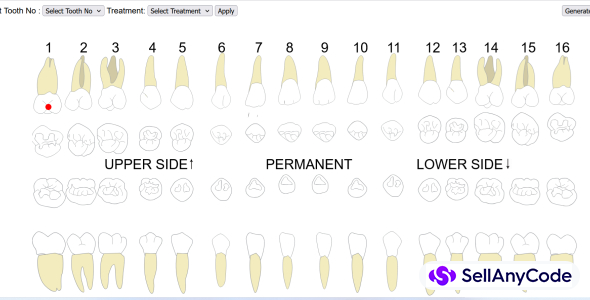 Dental Implants Tool