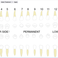 Dental Implants Tool